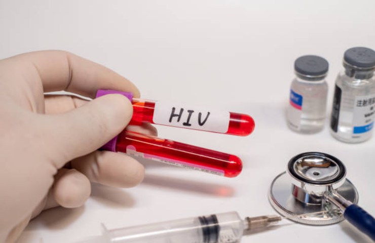 Fialette test HIV